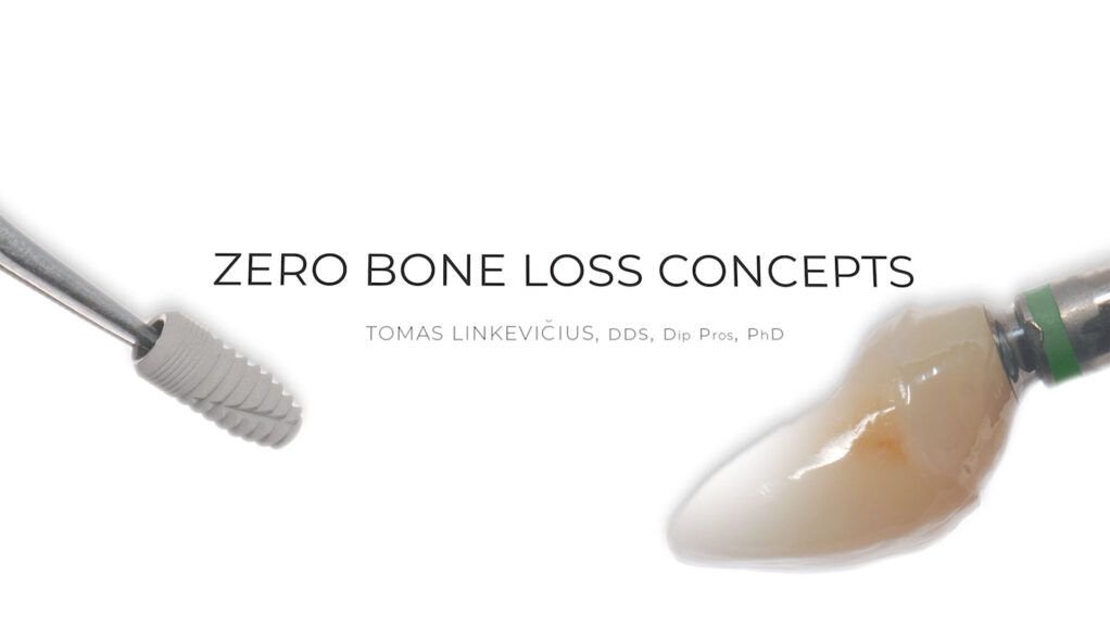 Zero Bone Loss Concepts - Prof. Tomas Linkevičius
